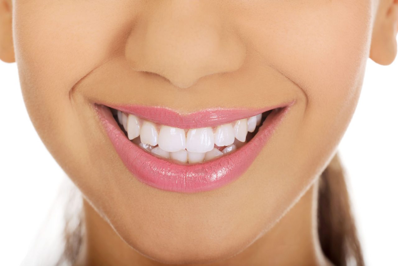 Teeth Whitening New Westminster Queensborough Dental Centre